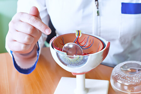 白内障手术的人工晶体如何选择？