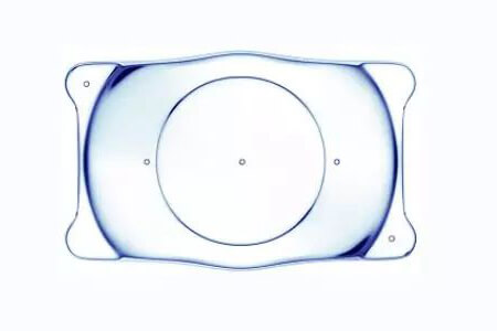  icl手术后还会近视吗？听专家怎么说