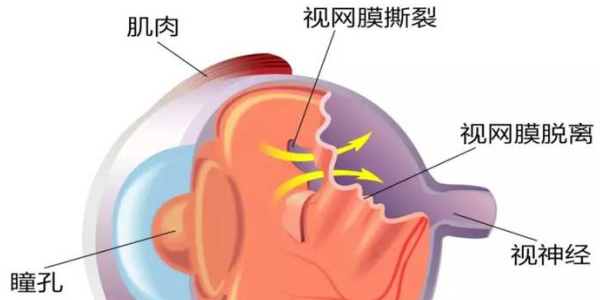 沃瑞眼科的近视眼手术好吗？