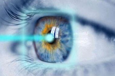 全飞秒激光近视手术原理是什么？具体流程是怎样的？
