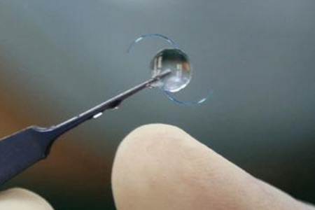 做PRL晶体植入术多少钱？