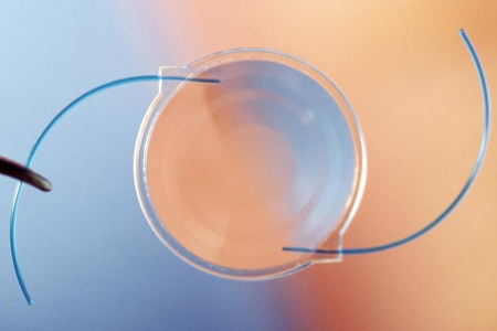 PRL晶体植入后可以维持多少年