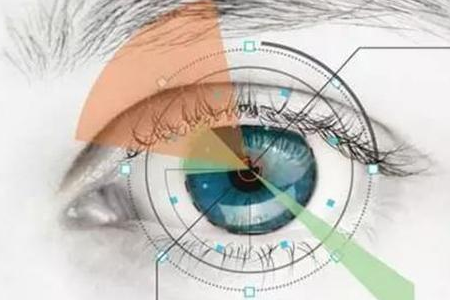 合肥近视手术ICL晶体植入术后必读