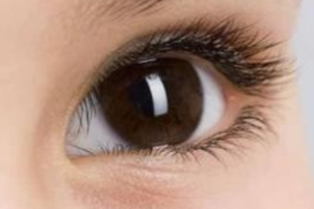 激光近视手术和ICL晶体植入哪个更好？